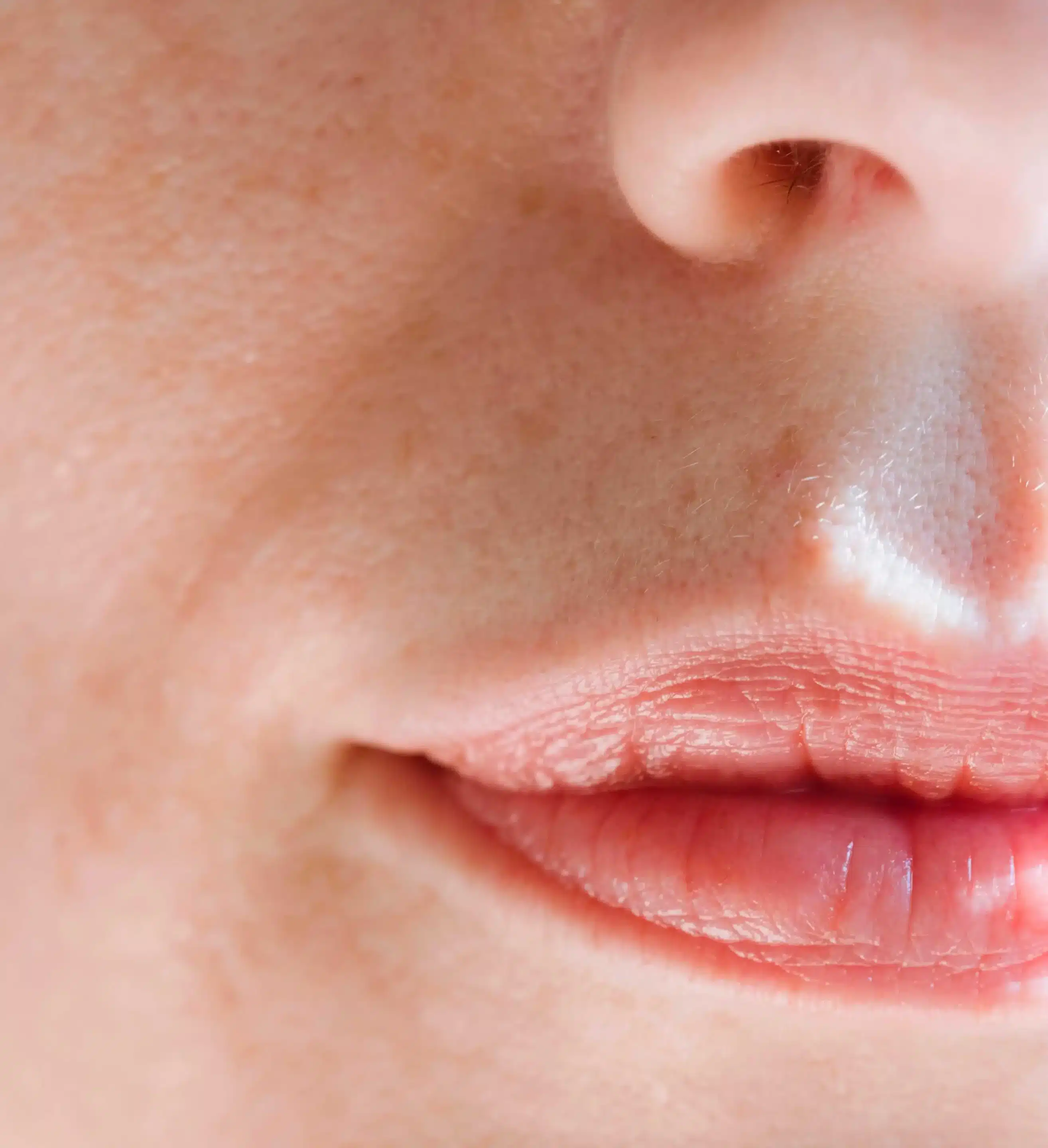 Pourquoi opter pour des injections d’acide hyaluronique dans les lèvres ?