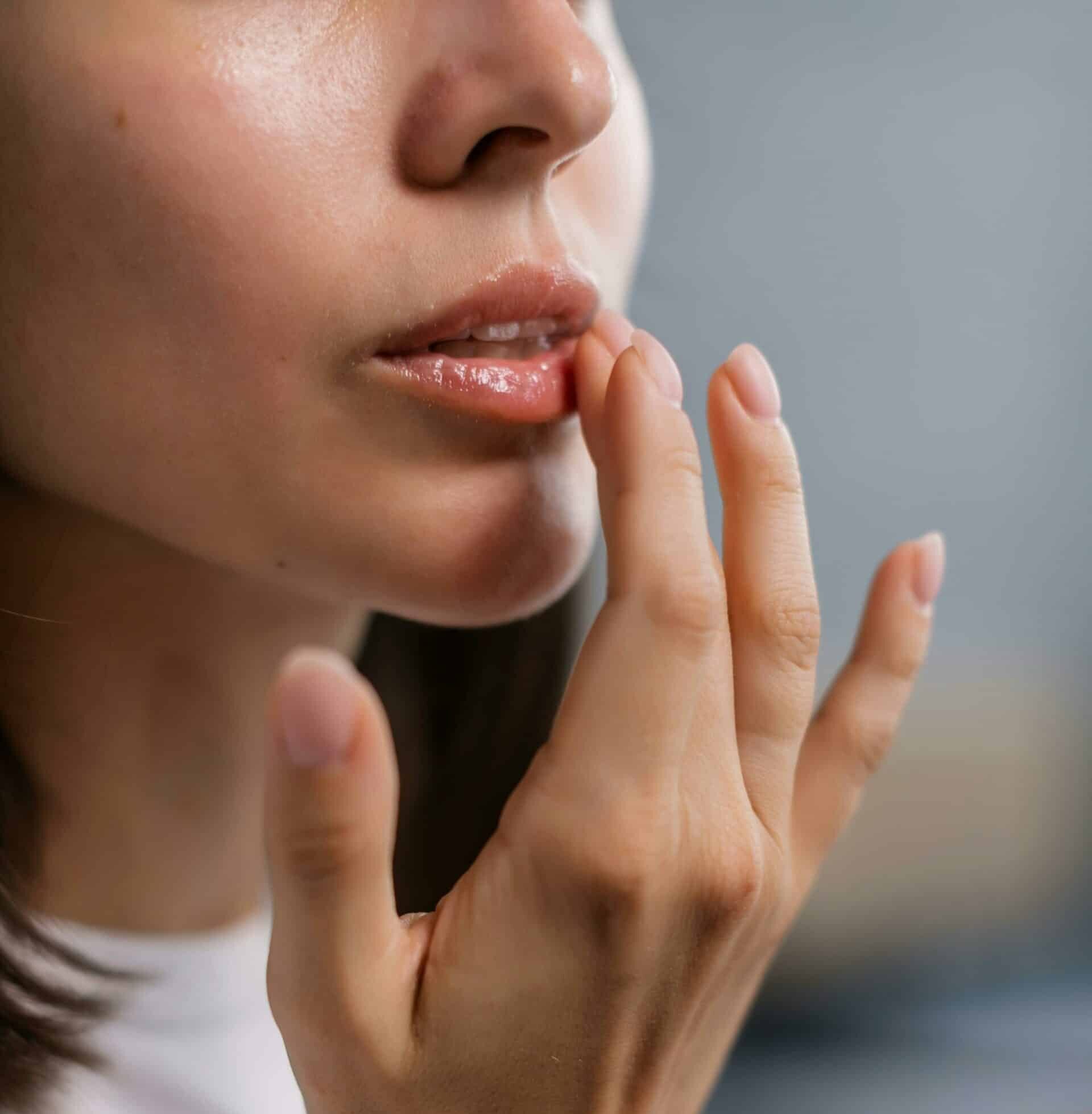 Injections d’acide hyaluronique dans les lèvres à Nice